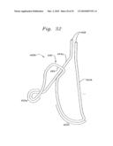 FLEXIBLE HEART VALVE AND ASSOCIATED CONNECTING BAND diagram and image