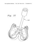 FLEXIBLE HEART VALVE AND ASSOCIATED CONNECTING BAND diagram and image