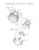 FLEXIBLE HEART VALVE AND ASSOCIATED CONNECTING BAND diagram and image