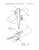 BARBED ANCHORS FOR WIRE STENT diagram and image