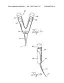 BARBED ANCHORS FOR WIRE STENT diagram and image