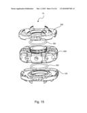 Universal Spinal Disc Implant System diagram and image