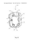 Universal Spinal Disc Implant System diagram and image