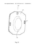 Universal Spinal Disc Implant System diagram and image