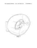 LARYNGEAL MASK AIRWAY DEVICE AND METHOD OF MANUFACTURE diagram and image