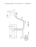 MOTORIZED BONE CEMENT MIXER CAPABLE OF MONITORING THE STATE OF THE CEMENT AS IT IS MIXED diagram and image