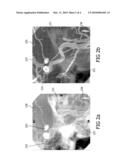 SPATIALLY VARYING 2D IMAGE PROCESSING BASED ON 3D IMAGE DATA diagram and image