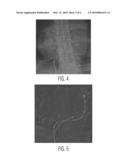 System for Removing Static Background Detail From Medical Image Sequences diagram and image