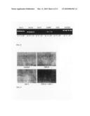 Tissue Engineered Cartilage, Method of Making Same, Therapeutic and Cosmetic Surgical Applications Using Same diagram and image