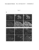 METHOD FOR PREPARING PANCREATIC BETA CELLS STARTING FROM BETA CELL PROGENITORS AND BETA CELLS THEREBY OBTAINED diagram and image