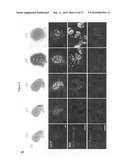 METHOD FOR PREPARING PANCREATIC BETA CELLS STARTING FROM BETA CELL PROGENITORS AND BETA CELLS THEREBY OBTAINED diagram and image