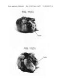 Graded Expression of Snail as Marker of Cancer Development and DNA Damage-Based Diseases diagram and image