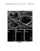 p75NTR MEDIATES EPHRIN-A REVERSE SIGNALING diagram and image