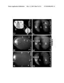 p75NTR MEDIATES EPHRIN-A REVERSE SIGNALING diagram and image