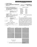 Rhamm, a Co-Receptor and Its Interactions with Other Receptors in Cancer Cell Motility and the Identification of Cancer Prognitor Cell Populations diagram and image