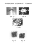 METHOD AND DEVICE FOR RADIOTHERAPY diagram and image