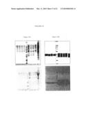 Method for Detecting Aggregate-Forming Circulating Protein Forms Using an Agent for Aggregating Said Forms and an Agent for Capturing Formed Aggregates diagram and image