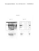 Method for Detecting Aggregate-Forming Circulating Protein Forms Using an Agent for Aggregating Said Forms and an Agent for Capturing Formed Aggregates diagram and image