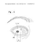 DEVICE FOR MEASURING AN ANALYTE IN AN EYE FLUID diagram and image