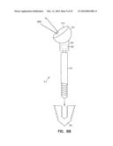 Fiducial Marker Devices, Tools, and Methods diagram and image