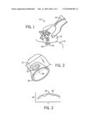 IMAGING SPECTROMETER FOR EARLY DETECTION OF SKIN CANCER diagram and image