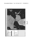 Method and system for measuring lung tissue damage and disease risk diagram and image