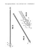 TROCAR ASSEMBLY WITH OBTURATOR DISSECTOR diagram and image