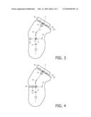 DEVICE AND METHOD FOR IMAGING SKIN OBJECTS, AND A METHOD AND DEVICE FOR REDUCING HAIR GROWTH BY MEANS THEREOF diagram and image