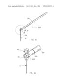 ERGONOMIC NEEDLE WALDO AND METHOD diagram and image