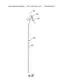 MEDICAL DEVICE FIXATION TOOL AND METHOD OF FIXATION OF A MEDICAL DEVICE diagram and image