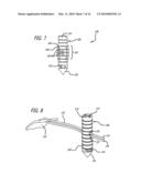 KNOTLESS SUTURE ANCHOR FOR SOFT TISSUE REPAIR AND METHOD OF USE diagram and image