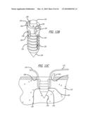 KNOTLESS SUTURE ANCHOR FOR SOFT TISSUE REPAIR AND METHOD OF USE diagram and image