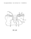 KNOTLESS SUTURE ANCHOR FOR SOFT TISSUE REPAIR AND METHOD OF USE diagram and image