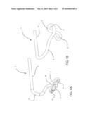 Internal Joint Stabilizer Device, System, and Method of Use diagram and image