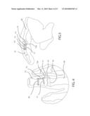 Internal Joint Stabilizer Device, System, and Method of Use diagram and image