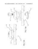 Internal Joint Stabilizer Device, System, and Method of Use diagram and image