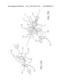 Internal Joint Stabilizer Device, System, and Method of Use diagram and image