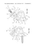 Internal Joint Stabilizer Device, System, and Method of Use diagram and image