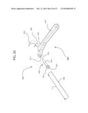 Internal Joint Stabilizer Device, System, and Method of Use diagram and image