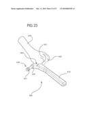 Internal Joint Stabilizer Device, System, and Method of Use diagram and image