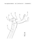 Internal Joint Stabilizer Device, System, and Method of Use diagram and image