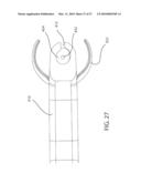 Internal Joint Stabilizer Device, System, and Method of Use diagram and image