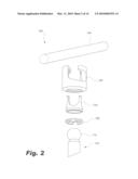 BONE FIXATION METHOD diagram and image