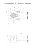 BONE FIXATION METHOD diagram and image