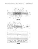 DELIVERY SYSTEM FOR ENDOLUMINAL IMPLANT diagram and image