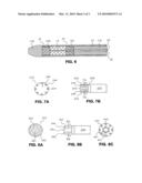 DELIVERY SYSTEM FOR ENDOLUMINAL IMPLANT diagram and image