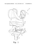 FIXED-BEARING KNEE PROSTHESIS HAVING INTERCHANGEABLE COMPONENTS diagram and image