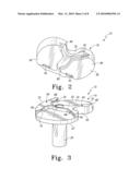 FIXED-BEARING KNEE PROSTHESIS HAVING INTERCHANGEABLE COMPONENTS diagram and image