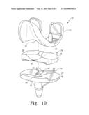 FIXED-BEARING KNEE PROSTHESIS HAVING INTERCHANGEABLE COMPONENTS diagram and image