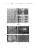 CROP GRAIN FILLING GENE GIF1 AND THE APPLICATIONS THEREOF diagram and image